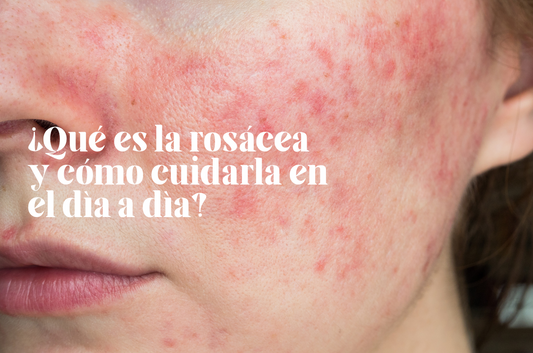 ¿Qué es la rosácea y cómo cuidarla en el día a día?